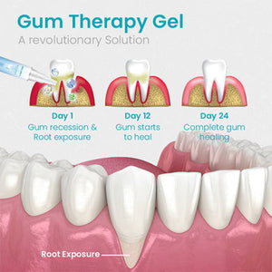NESLEMYâ„¢ Gum Shield Therapy Gel