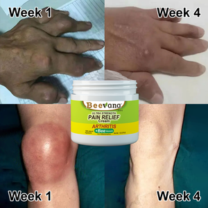 Beevanaâ„¢ Bee Venom Joint & Bone Therapy Cream (Full Body Recovery, Pure Natural Formula)