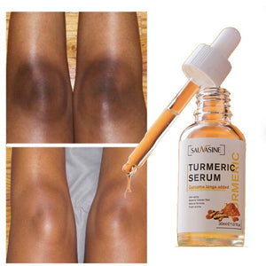 Turmeric Lemon Oil Skin Glow To Lightening Acne Dark Patches, Acne Bright Skin Dark Spot Corrector Whitening Serum Skin Care