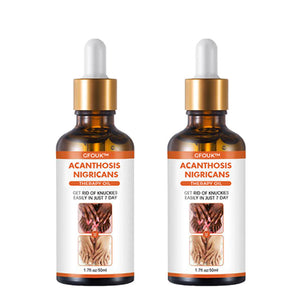 Mytrendster™ Skin pigmentation Acanthosis Nigricans Therapy Oil